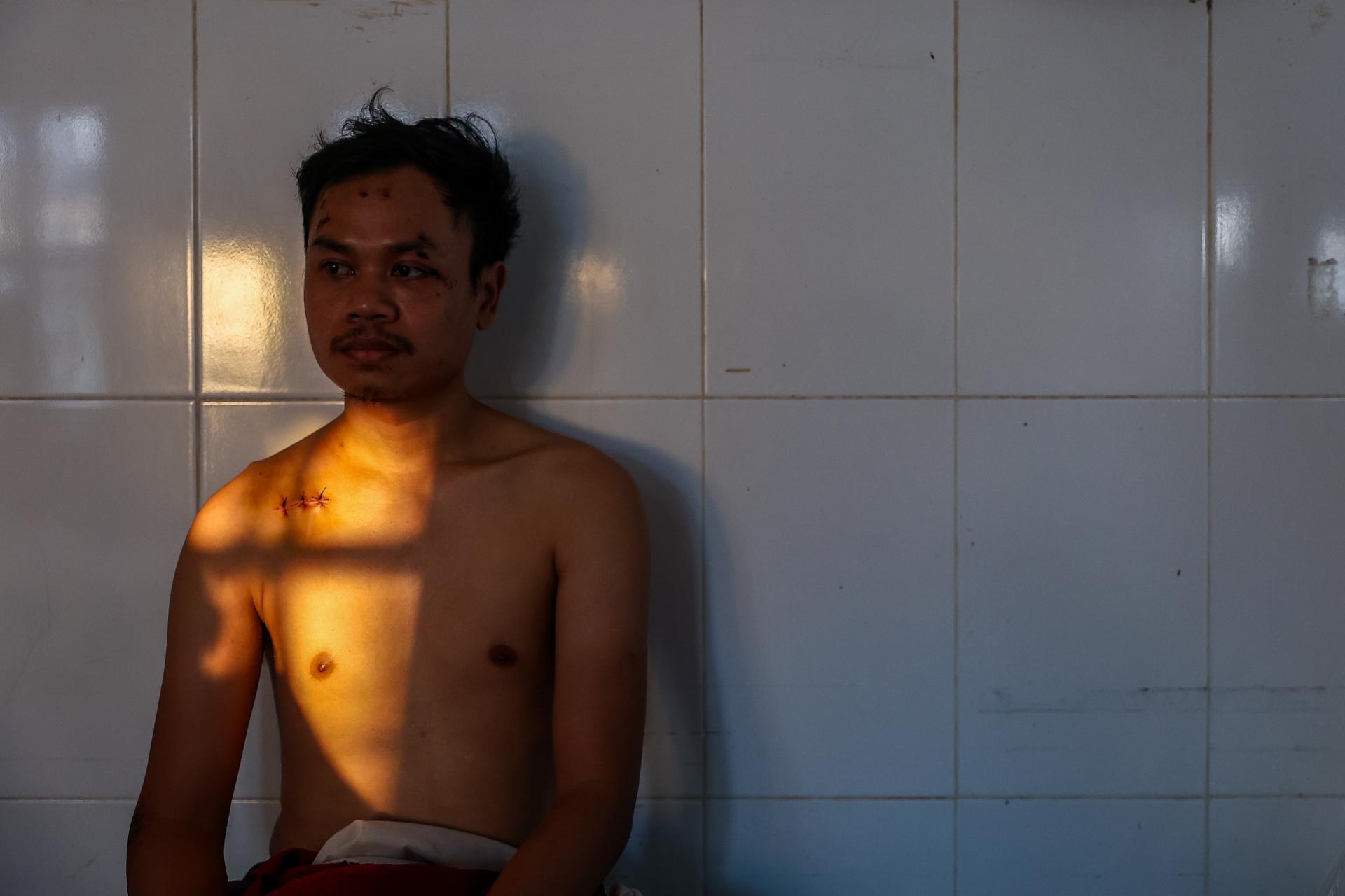 Global Photography Awards Winner - Deadliest Thai-Cambodian Border Conflict 